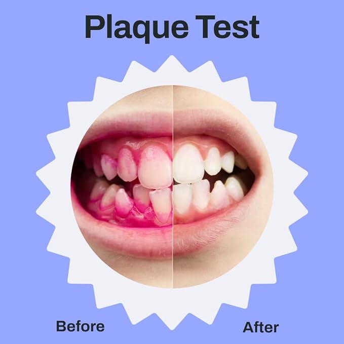 autobrush Kids U Shaped Electric Toothbrush, ADA Accepted, Sonic Pro with Unique 360° Nylon Bristles 3 Cleaning Modes,Whitening LED-Lights,Plays Music (Double-Sided),Ages 9-12, Lion